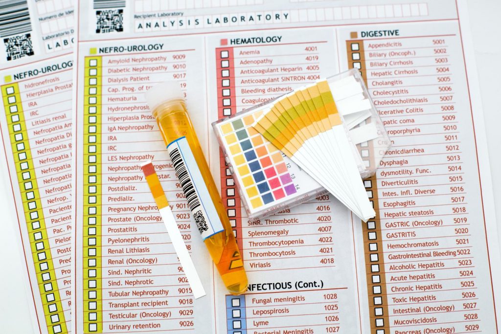 common urologic tests laid out on a table